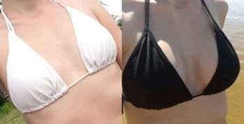 Breast enlargement cream wow bust-before and after use