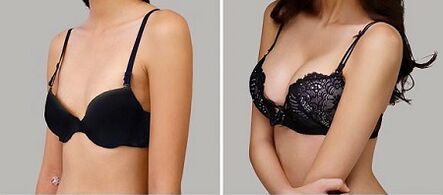 Photo before and after breast growth