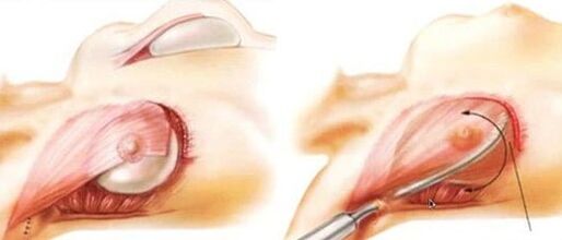 How is the breast growth function performed